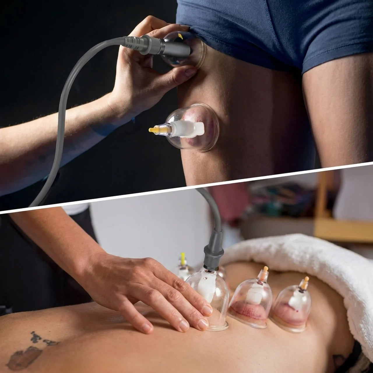 Kit Ventouses Hijama Professionnel 24 Tasses
